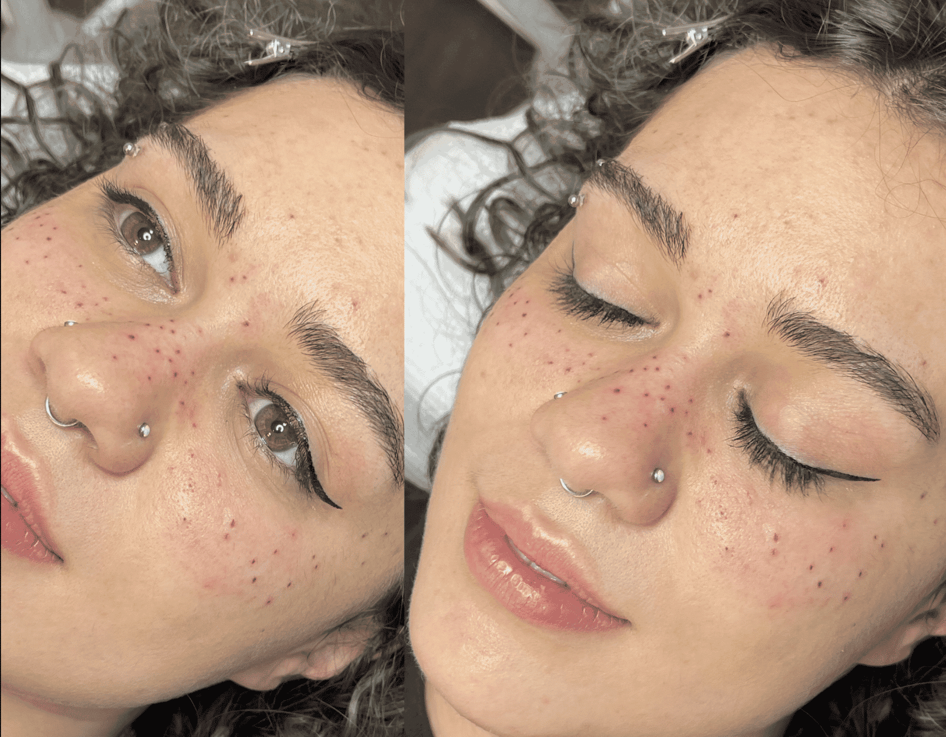 Woman Tattoos Freckles On Face