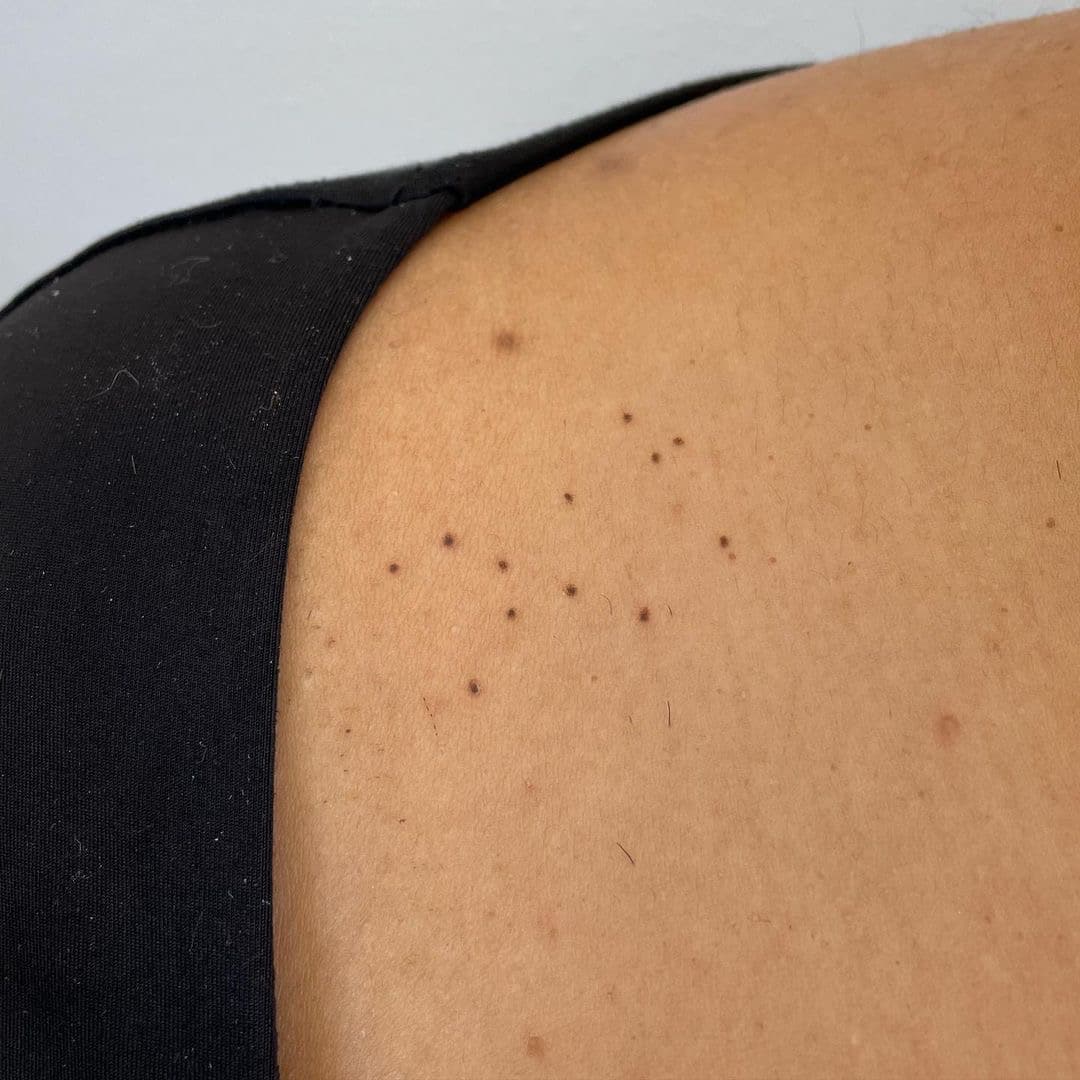 My secret tattoo Part of the Great Bear constellation as freckles by Maya  Viala Darmstadt  rtattoos